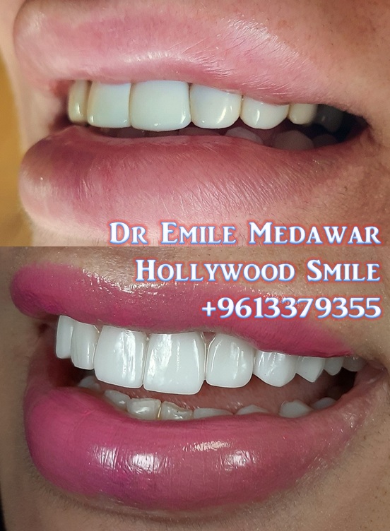 Best dentist in Lebanon Beirut